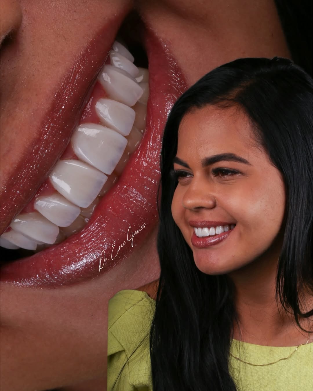Sorriso e detalhe dos dentes